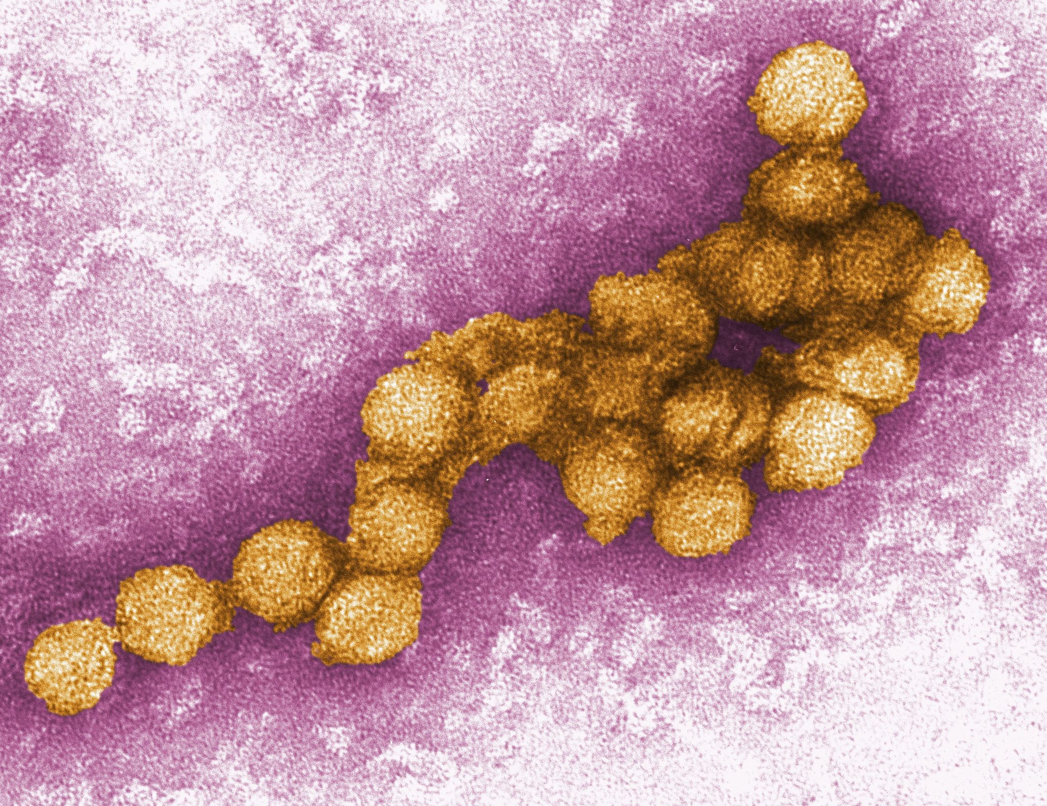 West-Nil-Virus © Foto: Cynthia Goldsmith/CENTERS FOR DISEASE CONTROL/EPA/dpa